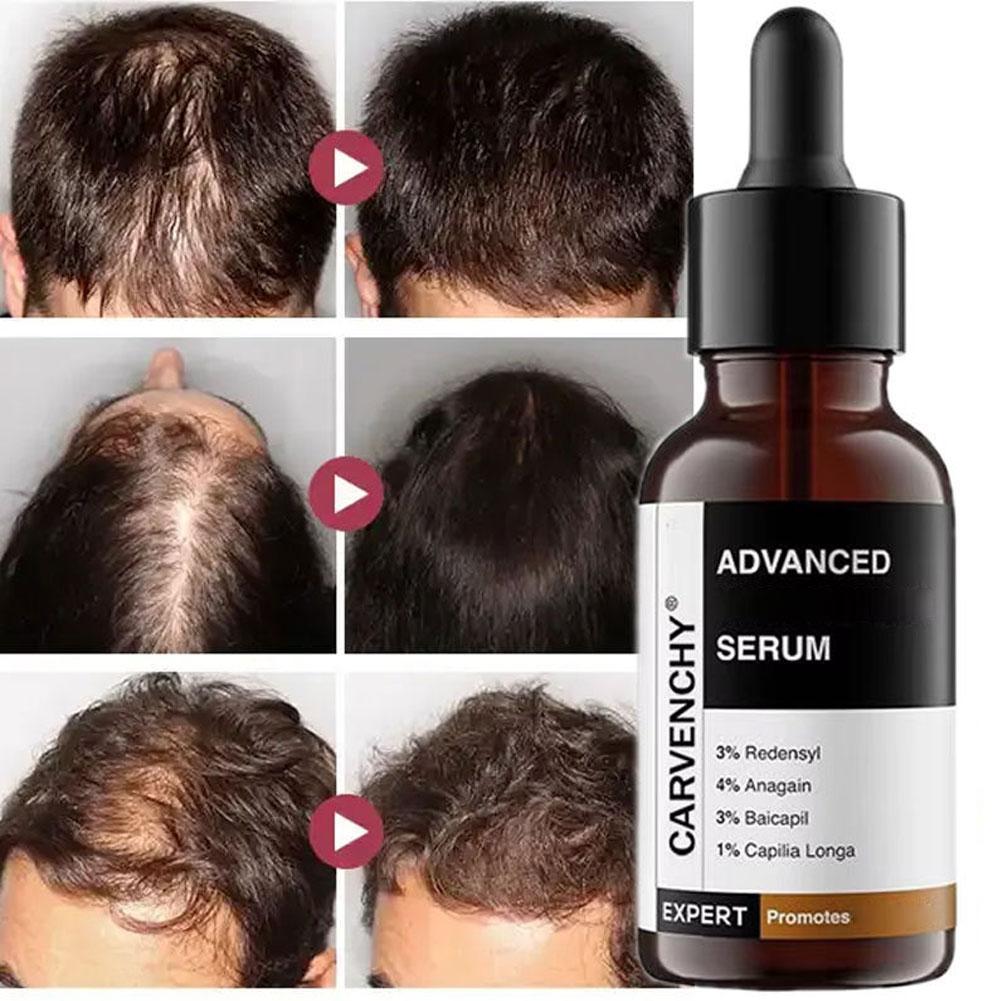 Hair Care For Men - Rosemary Essential Oil For Hair Care