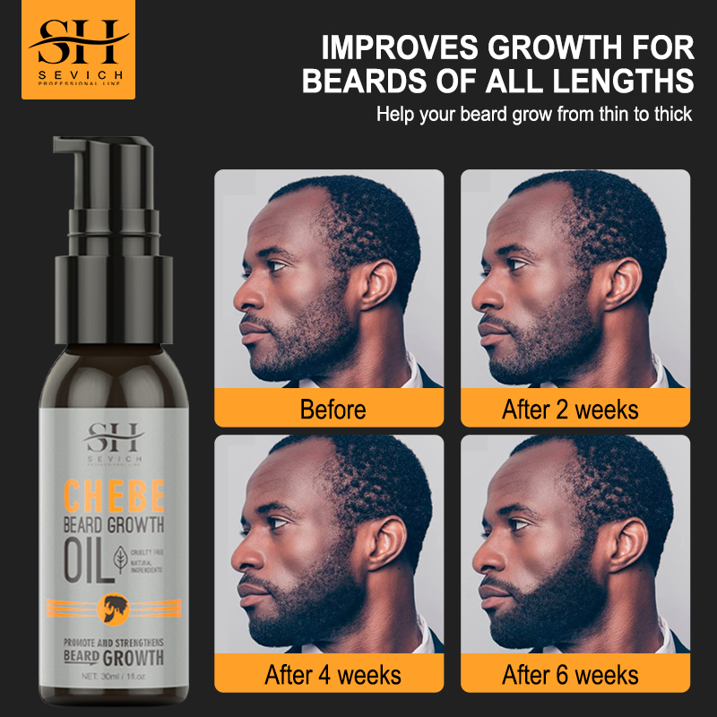 Hair Care For Men - Sevich Men Beard Growth Essential Chebe