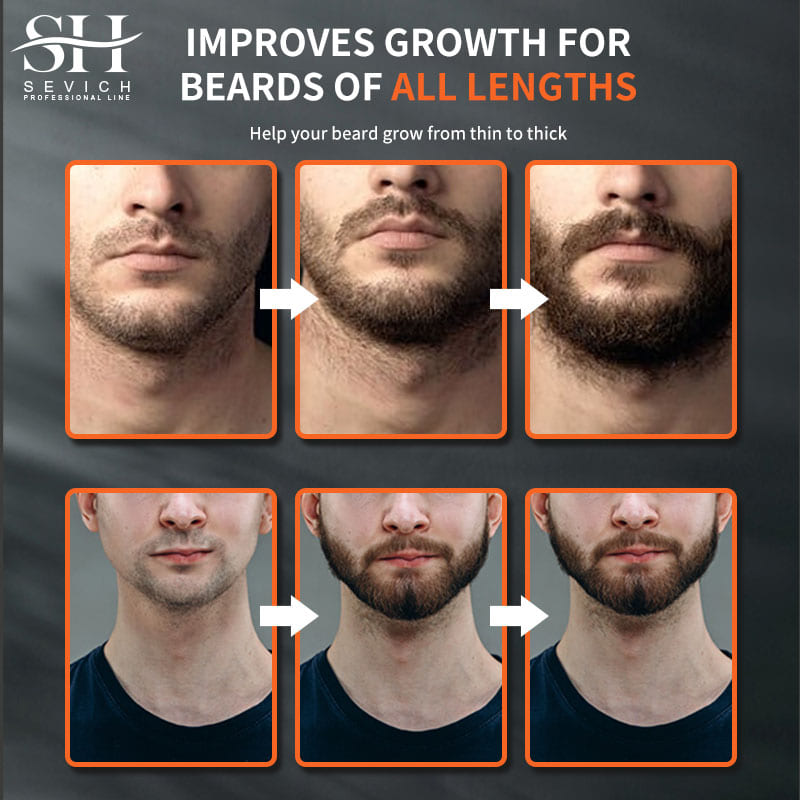 Sevich Men Beard Growth Essent – Hair Care For Men Bewertung und Preis