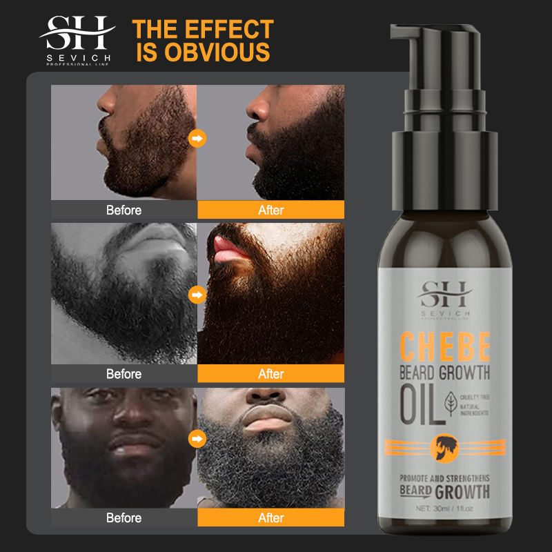 Sevich Men Beard Growth Essent – Hair Care For Men Bewertung und Preis