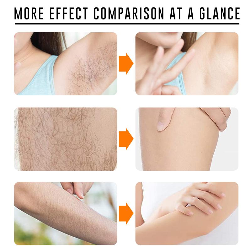Fast Hair Removal Spray Painle – Hair Care For Men Bewertung und Preis